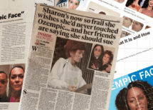 Ozempic tongue, Ozempic face – are these side effects real? Should we worry?