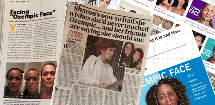 Ozempic tongue, Ozempic face – are these side effects real? Should we worry?