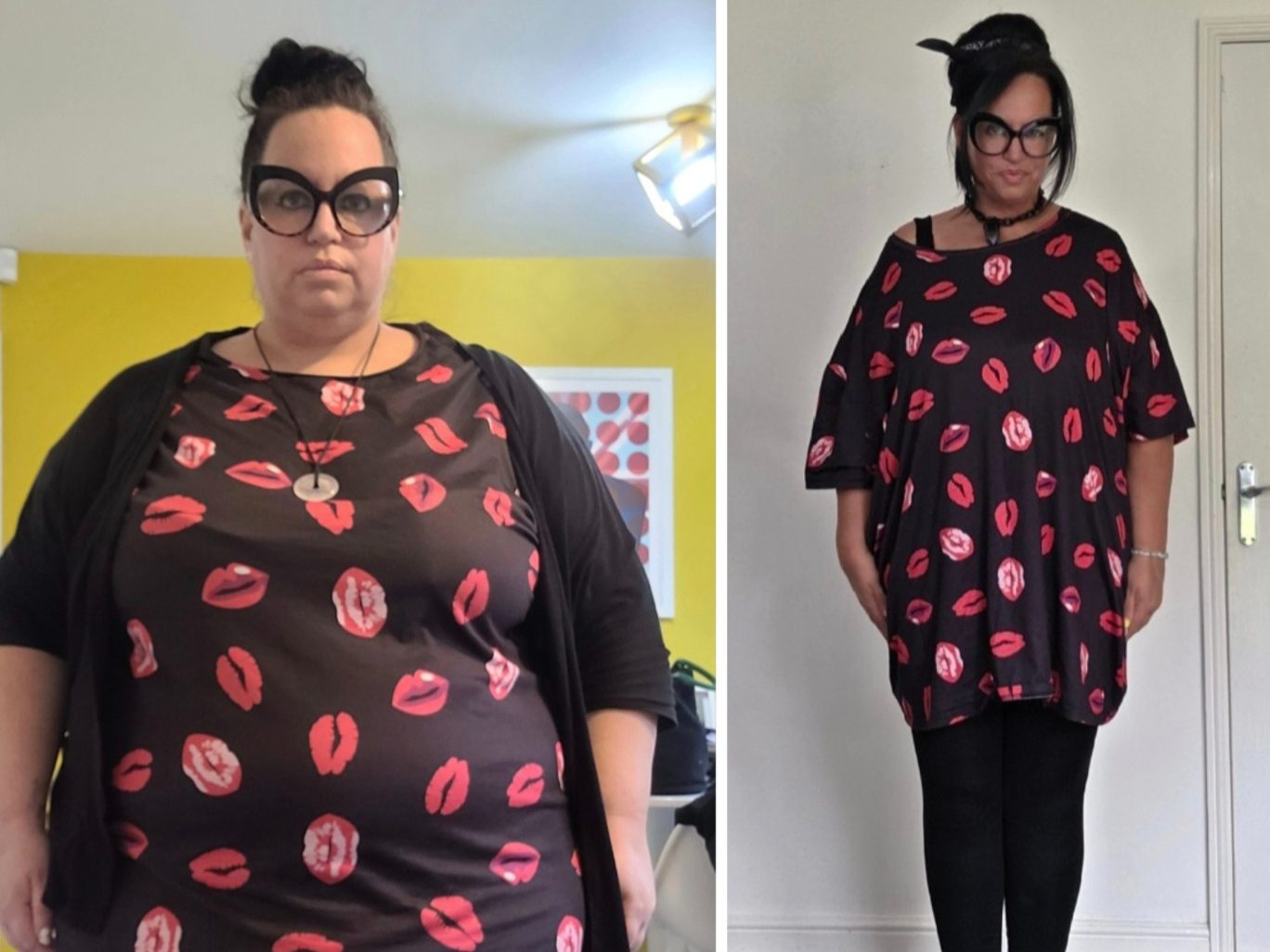 Mounjaro 11 stone weight loss story