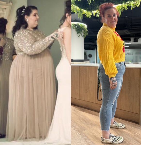 Mounjaro better than a gastric band Lozzii